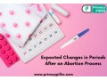 expected-changes-in-periods-after-an-abortion-process-small-0