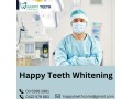 happy-teeth-whitening-small-0