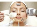 laser-treatments-denver-small-0